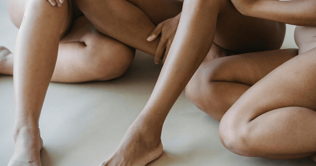 Hyperpigmentation - 3 ladies with smooth skin